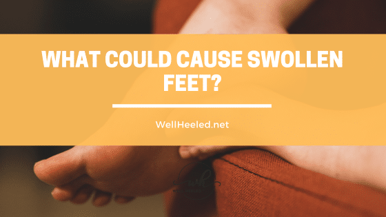 What Can Cause Swollen Feet or Swollen Foot