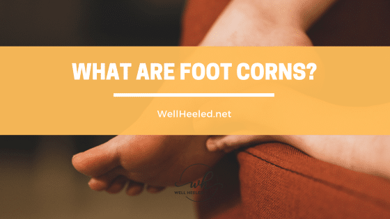 What are foot corns
