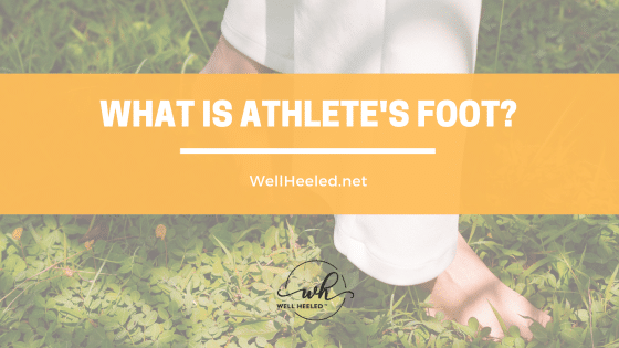 What is Athlete's Foot