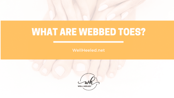 What are webbed toes